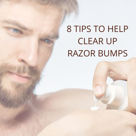 8 Tips To Help Clear up Razor Bumps